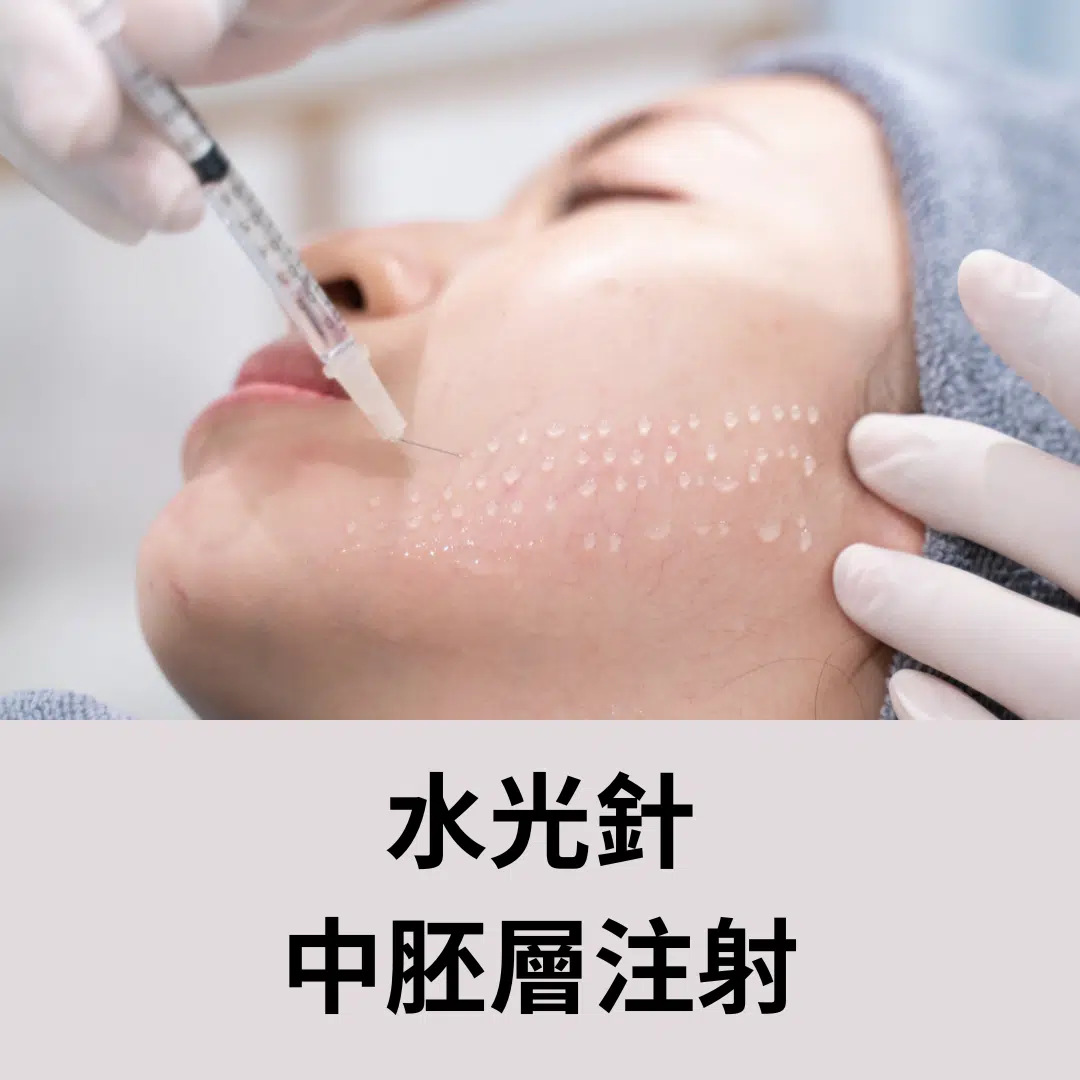 水光針是什麼？ 中胚層療法、水光針價格、效果、副作用大解析