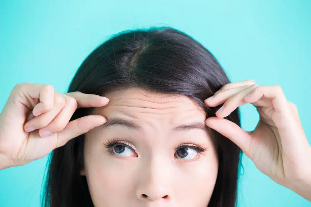 抬頭紋、魚尾紋醫美有什麼療程能消除？各項推薦醫美一次告訴你