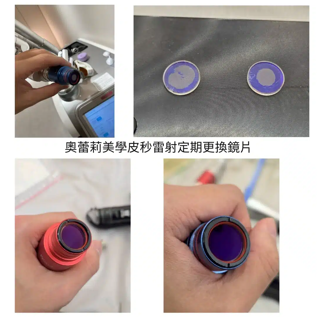 奧蕾莉 皮秒雷射 鏡片更換