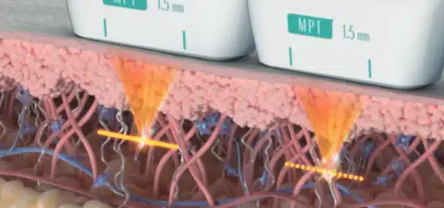 MPT音波原理