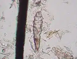 儒型蟎蟲 Demodex